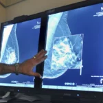 opinion - breast cancer